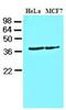 Casein Kinase 1 Alpha 1 antibody, NBP1-30165, Novus Biologicals, Western Blot image 