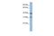 Mitochondrially Encoded Cytochrome C Oxidase III antibody, GTX45887, GeneTex, Western Blot image 