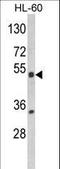 Nuclear Receptor Subfamily 1 Group I Member 2 antibody, LS-C162987, Lifespan Biosciences, Western Blot image 