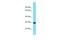 Haloacid Dehalogenase Like Hydrolase Domain Containing 3 antibody, A17234, Boster Biological Technology, Western Blot image 