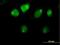 Zinc Finger And BTB Domain Containing 26 antibody, H00057684-B01P, Novus Biologicals, Immunocytochemistry image 