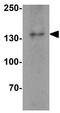 Interleukin 17 Receptor A antibody, GTX16598, GeneTex, Western Blot image 