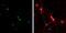 High Mobility Group Box 1 antibody, GTX629403, GeneTex, Immunofluorescence image 