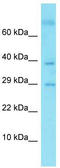 GLIPR2 antibody, TA337321, Origene, Western Blot image 