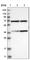 Mitochondrial Trans-2-Enoyl-CoA Reductase antibody, HPA022030, Atlas Antibodies, Western Blot image 