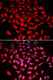 Calcium/Calmodulin Dependent Protein Kinase IV antibody, 19-573, ProSci, Immunofluorescence image 