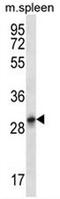 Keratin 222 antibody, AP52412PU-N, Origene, Western Blot image 
