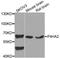 Prolyl 4-Hydroxylase Subunit Alpha 2 antibody, A4262, ABclonal Technology, Western Blot image 