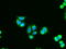 Adenylate Kinase 1 antibody, LS-C114473, Lifespan Biosciences, Immunofluorescence image 