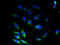 SSR-gamma antibody, A61154-100, Epigentek, Immunofluorescence image 