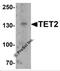 Tet Methylcytosine Dioxygenase 2 antibody, 6915, ProSci, Western Blot image 