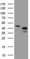 Ankyrin Repeat Family A Member 2 antibody, CF808378, Origene, Western Blot image 