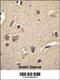 S100 Calcium Binding Protein A1 antibody, 56-036, ProSci, Immunohistochemistry frozen image 