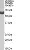 Integrin Subunit Alpha 1 antibody, 43-636, ProSci, Enzyme Linked Immunosorbent Assay image 