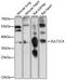 Sulfotransferase Family 1C Member 4 antibody, LS-C750401, Lifespan Biosciences, Western Blot image 