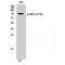 Receptor Interacting Serine/Threonine Kinase 2 antibody, OASG06442, Aviva Systems Biology, Western Blot image 