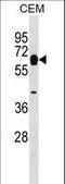 Myotilin antibody, LS-C158348, Lifespan Biosciences, Western Blot image 