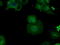 Betaine--Homocysteine S-Methyltransferase antibody, LS-C115014, Lifespan Biosciences, Immunofluorescence image 