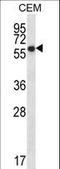 Endoplasmic Reticulum Oxidoreductase 1 Alpha antibody, LS-C167813, Lifespan Biosciences, Western Blot image 