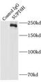 SPT6 Homolog, Histone Chaperone And Transcription Elongation Factor antibody, FNab08395, FineTest, Immunoprecipitation image 