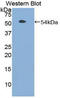 Toll Like Receptor 3 antibody, LS-C299521, Lifespan Biosciences, Western Blot image 