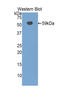 Solute Carrier Family 3 Member 2 antibody, LS-C296477, Lifespan Biosciences, Western Blot image 