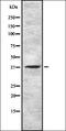 Gonadotropin Releasing Hormone Receptor antibody, orb337268, Biorbyt, Western Blot image 