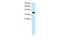 Nuclear Receptor Subfamily 4 Group A Member 1 antibody, GTX77817, GeneTex, Western Blot image 