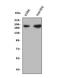 NPHS1 Adhesion Molecule, Nephrin antibody, A01991, Boster Biological Technology, Western Blot image 