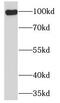 Toll Like Receptor 6 antibody, FNab08729, FineTest, Western Blot image 