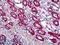 DExH-Box Helicase 9 antibody, LS-B5394, Lifespan Biosciences, Immunohistochemistry paraffin image 