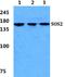 SOS Ras/Rho Guanine Nucleotide Exchange Factor 2 antibody, A05957-1, Boster Biological Technology, Western Blot image 