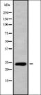P21 (RAC1) Activated Kinase 6 antibody, orb336323, Biorbyt, Western Blot image 