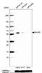 Alpha 2-HS Glycoprotein antibody, NBP1-90303, Novus Biologicals, Western Blot image 