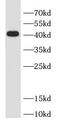 TARBP2 Subunit Of RISC Loading Complex antibody, FNab08956, FineTest, Western Blot image 