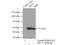 Ribosomal Oxygenase 2 antibody, 12214-1-AP, Proteintech Group, Immunoprecipitation image 