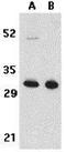 TNF Receptor Superfamily Member 13B antibody, GTX31266, GeneTex, Western Blot image 