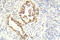 STK11 antibody, LS-C178109, Lifespan Biosciences, Immunohistochemistry paraffin image 