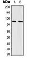 Signal Transducer And Activator Of Transcription 5A antibody, orb224012, Biorbyt, Western Blot image 
