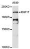 RING finger protein 17 antibody, LS-C748838, Lifespan Biosciences, Western Blot image 