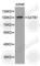 SATB Homeobox 1 antibody, A2602, ABclonal Technology, Western Blot image 