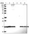 Small Ubiquitin Like Modifier 4 antibody, NBP2-34073, Novus Biologicals, Western Blot image 