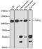 TSPY Like 2 antibody, A13118, ABclonal Technology, Western Blot image 