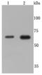 TNF Receptor Superfamily Member 1B antibody, A01437, Boster Biological Technology, Western Blot image 