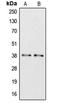 Apolipoprotein L6 antibody, LS-C353580, Lifespan Biosciences, Western Blot image 