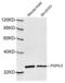 Ubiquitin C-Terminal Hydrolase L1 antibody, LS-C203133, Lifespan Biosciences, Western Blot image 