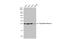 Thymidine Kinase 1 antibody, GTX113281, GeneTex, Western Blot image 