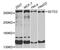 SET Domain Containing 2, Histone Lysine Methyltransferase antibody, abx002294, Abbexa, Western Blot image 