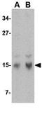 Stathmin 1 antibody, GTX31760, GeneTex, Western Blot image 