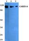 Caspase Recruitment Domain Family Member 14 antibody, PA5-75827, Invitrogen Antibodies, Western Blot image 